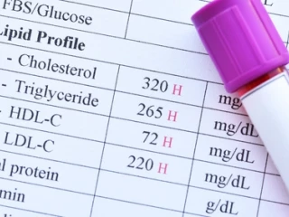 cholesterol_test