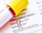 biomarker