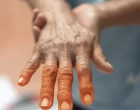 diabeticka_neuropatie_ruce