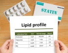 statin_lipidy_statiny