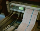 ekg_pristor_mereni_srdce_tep