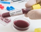 marker_markery_rakovina_krev_test_laborator_zkumavka