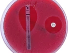 horova_clanek_antiinfektiva