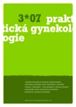 Číslo 3