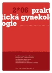 Číslo 2