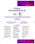 Issue 1