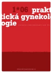 Číslo 1