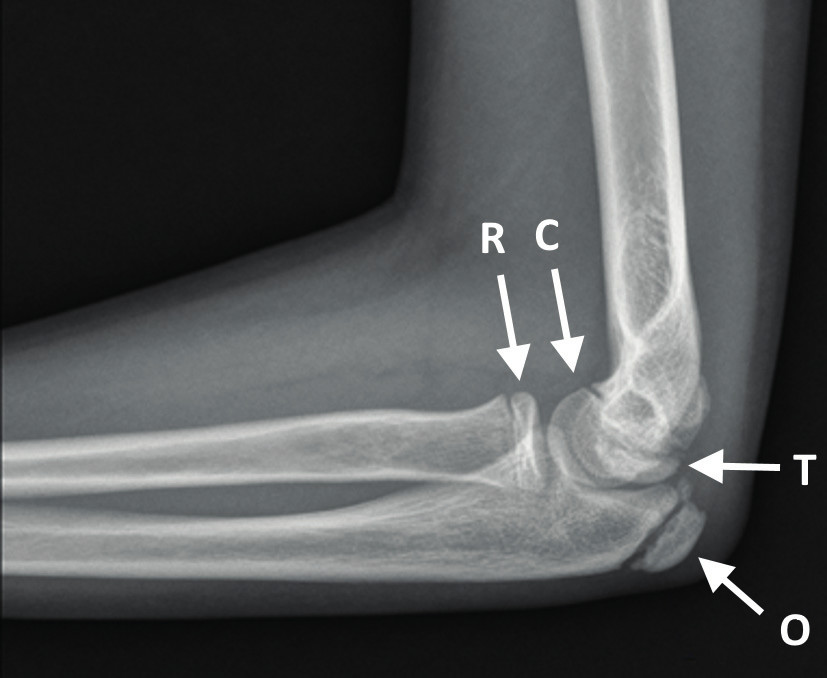 Olecranon Ossification Center